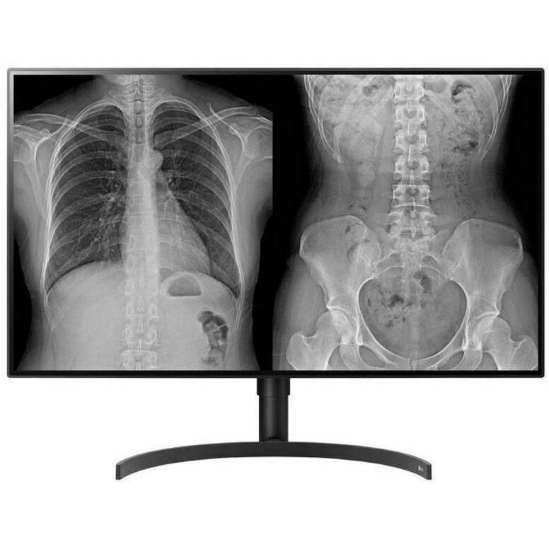 LG 32HL512D-B 32" Class 4K UHD LCD Monitor - 16:9 - Black - TAA Compliant