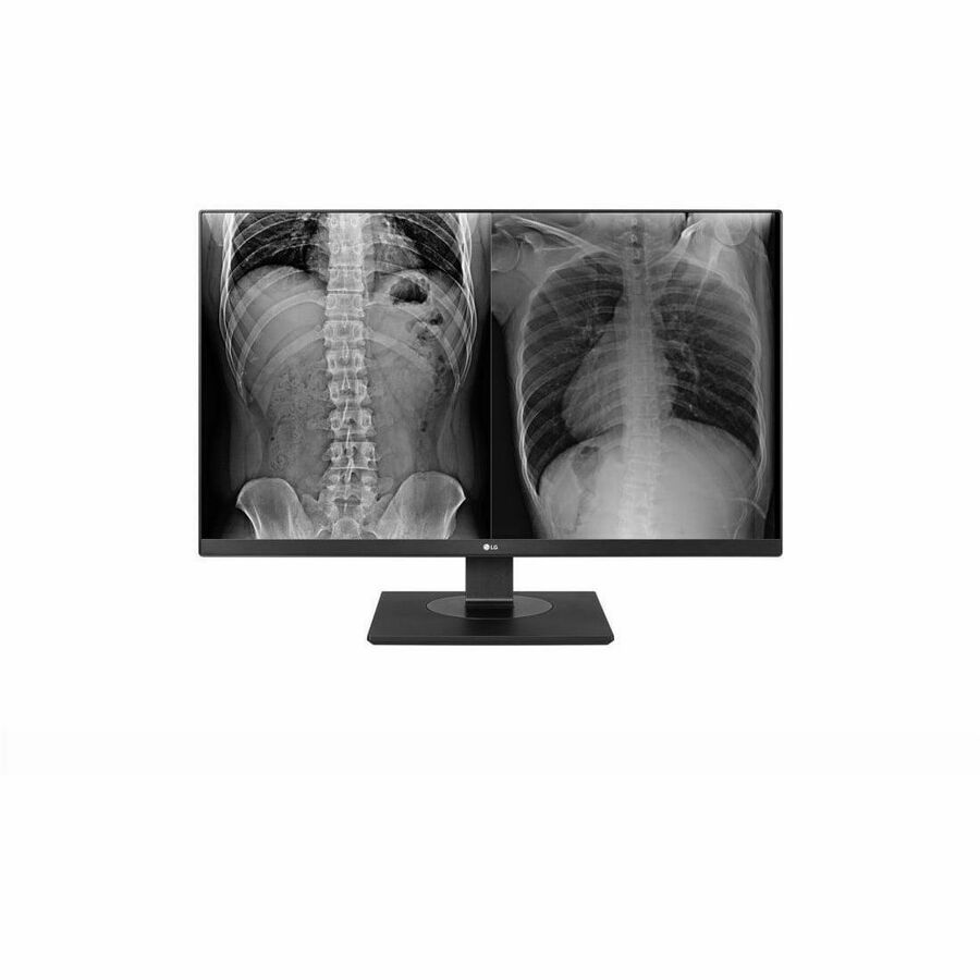 LG 27HJ713C-B 27" Class 4K UHD LCD Monitor - 16:9 - Black - TAA Compliant